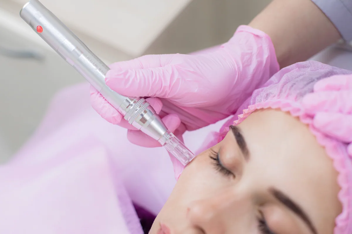 DermaPen