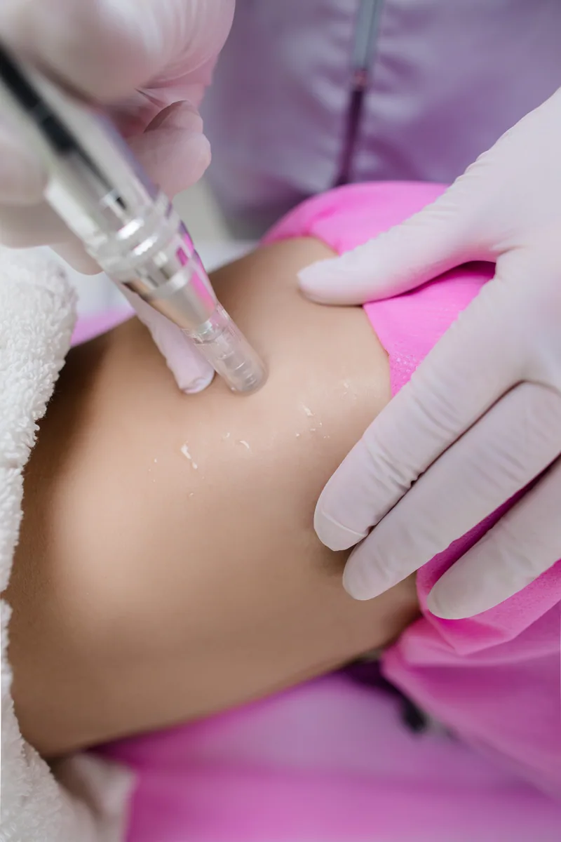 DermaPen corp